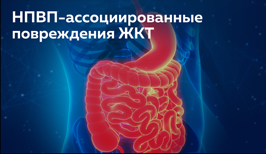 НПВП-ассоциированные повреждения ЖКТ