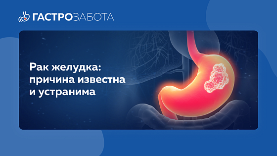 Рак желудка: причина известна и устранима